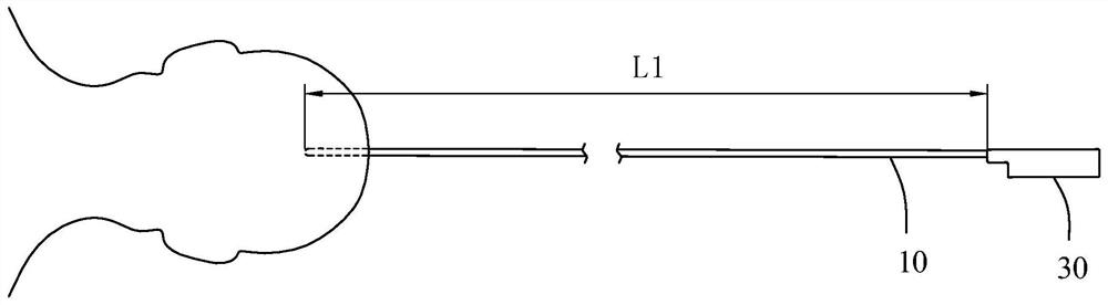 deep intracranial electrodes