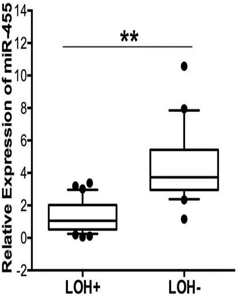 Esophageal carcinoma prognosis marker and application thereof