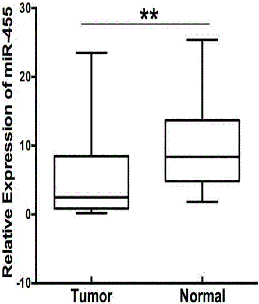 Esophageal carcinoma prognosis marker and application thereof