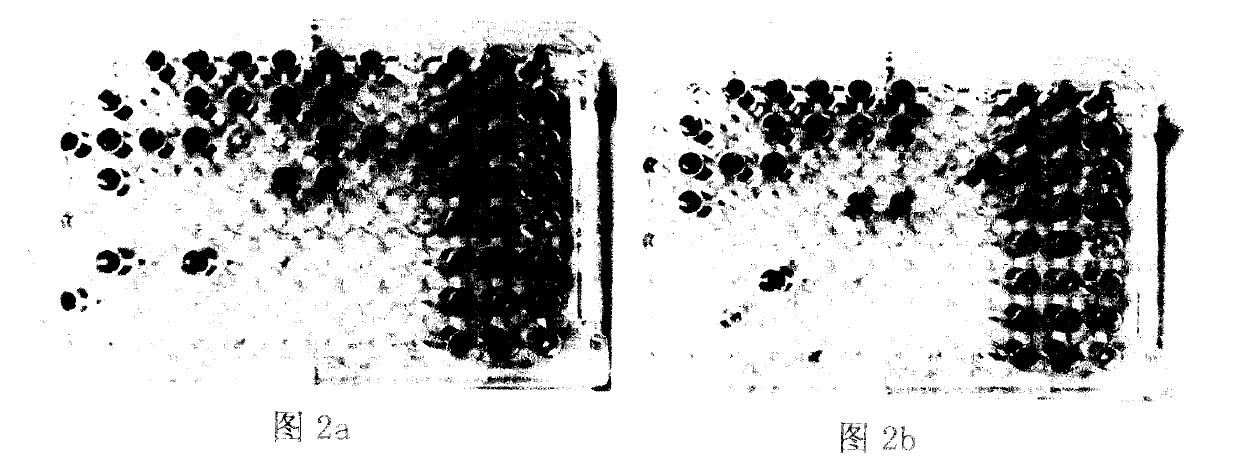 Space enterococcus faecium LCT (Liquid-based Cytology Test )-EF301