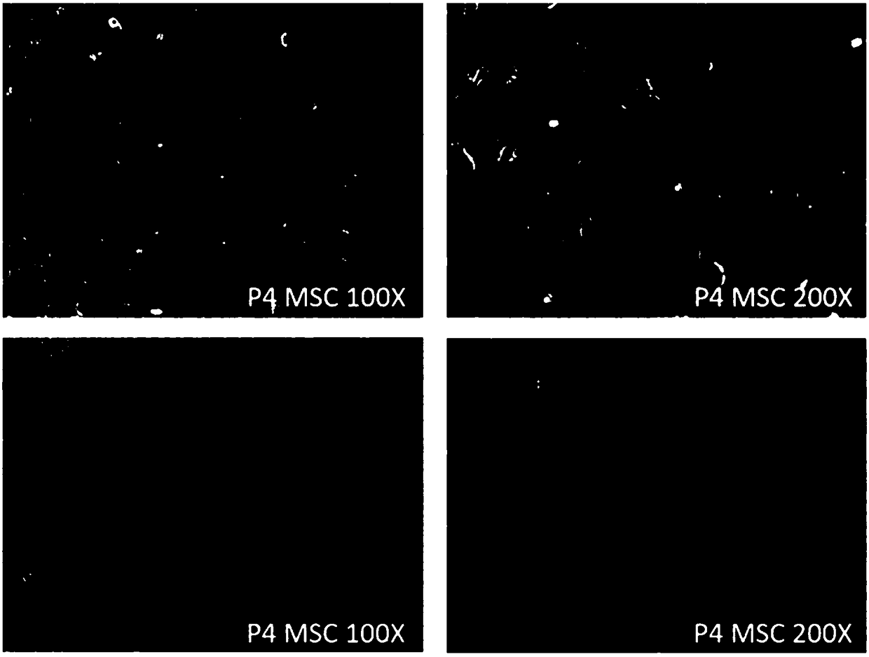 Application of mesenchymal stem cell exosome in preparation of drug preparation for promoting hair regeneration