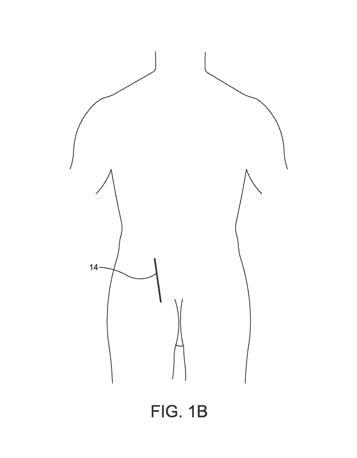 Tool and method for implanting fusion device into sacroiliac joint