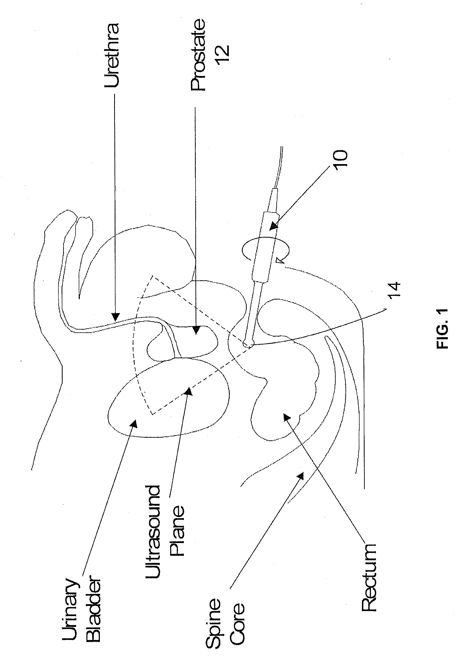 Universal ultrasound holder and rotation device