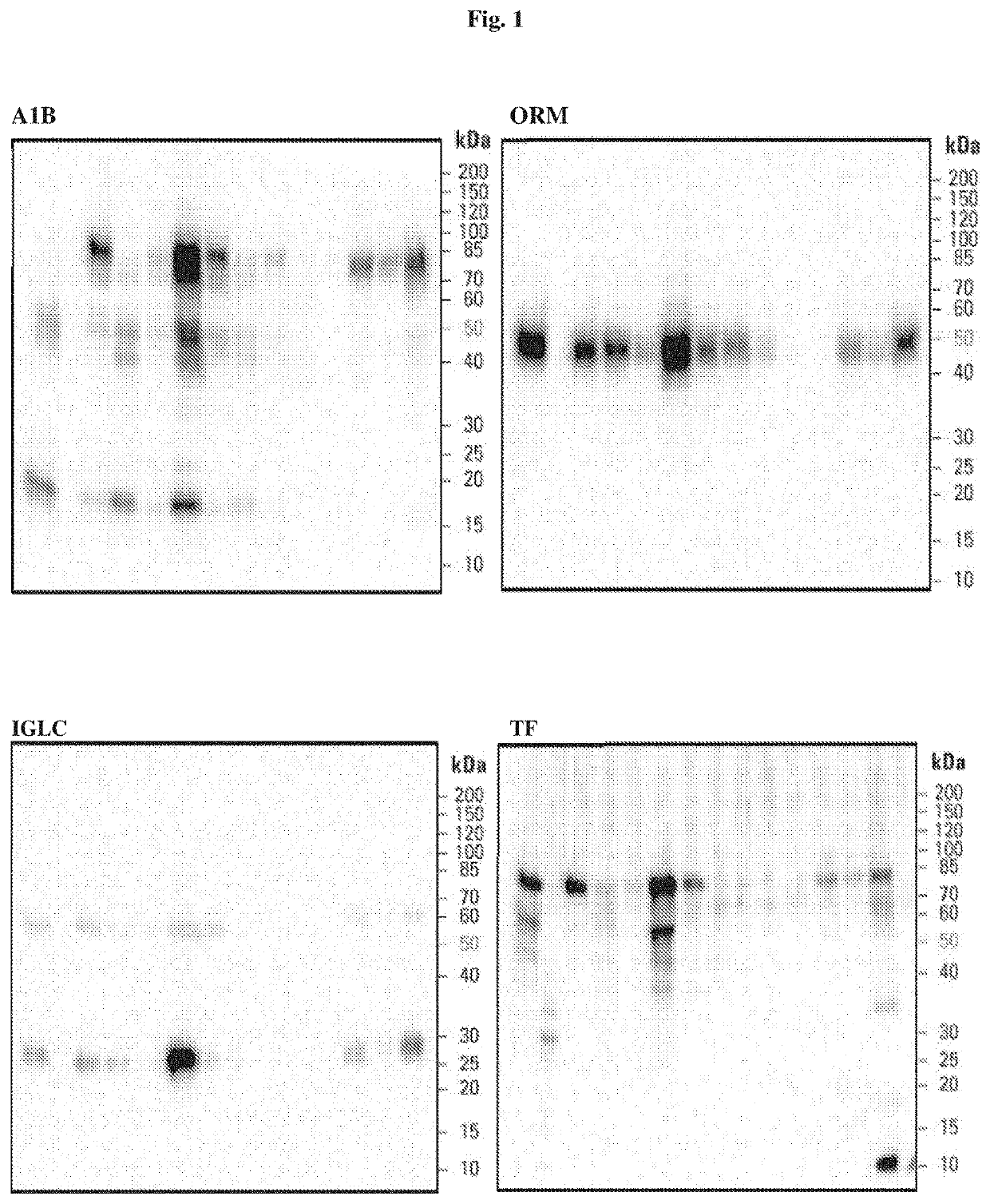 Methods for diagnosis, differentiation and monitoring using urine proteins as markers in iga nephropathy