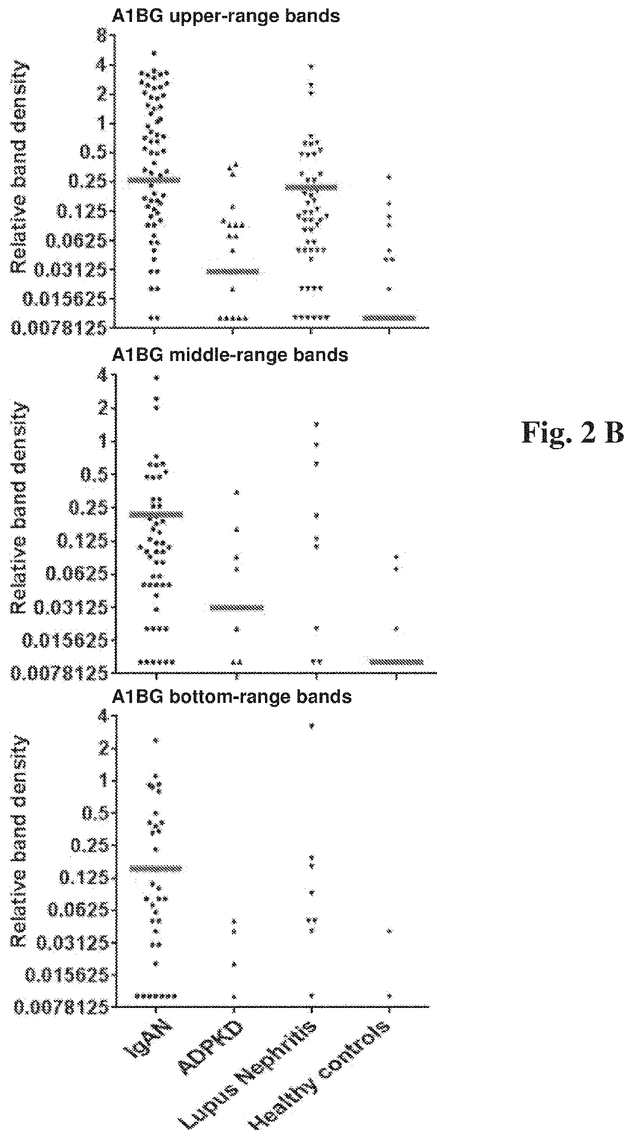 Methods for diagnosis, differentiation and monitoring using urine proteins as markers in iga nephropathy