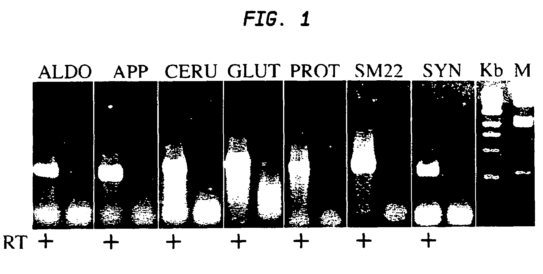 Multi-lineage directed induction of bone marrow stromal cell differentiation