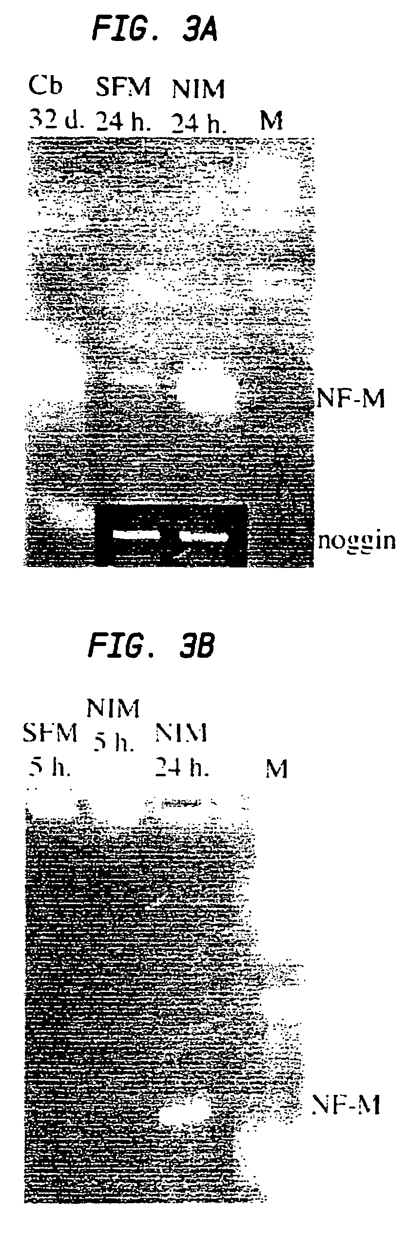 Multi-lineage directed induction of bone marrow stromal cell differentiation