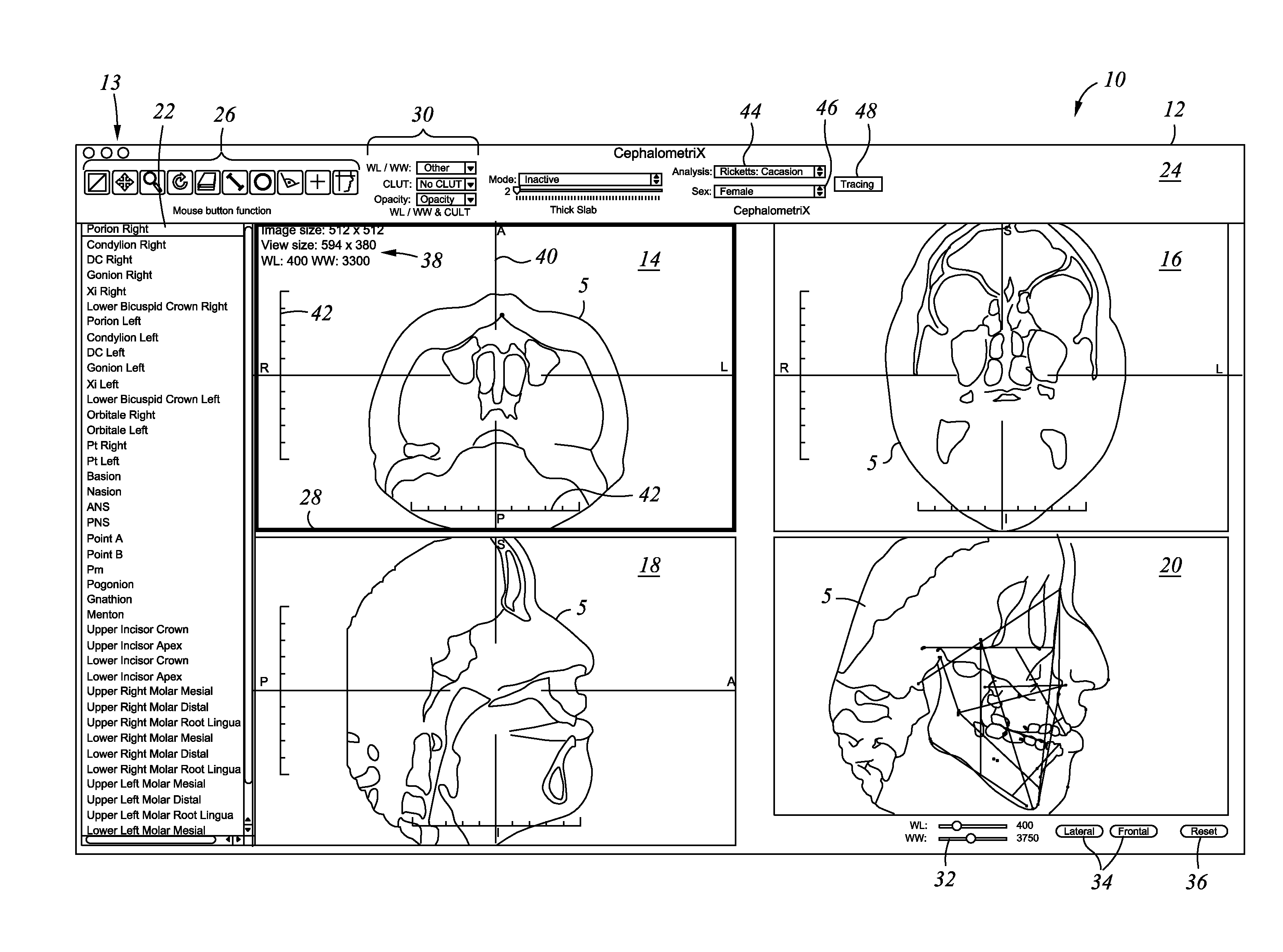 Method and system for orthodontic diagnosis