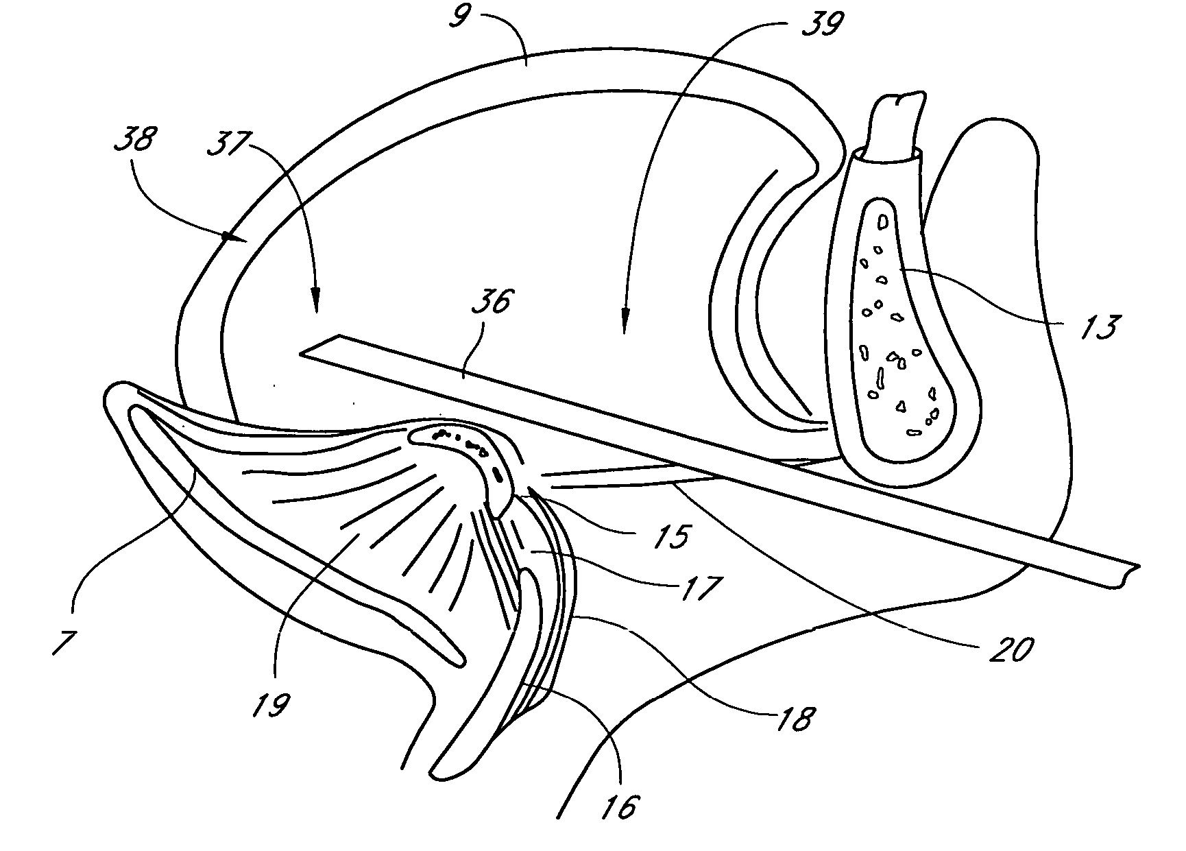 Method for adjusting tissue anchors