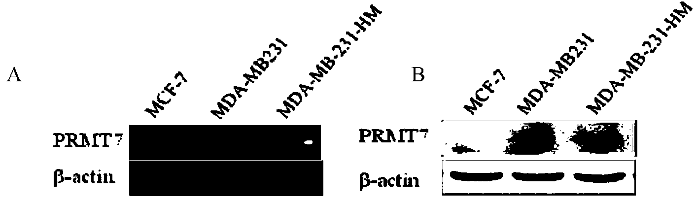 Application of protein arginine methyltransferase 7 in cancer cell metastasis