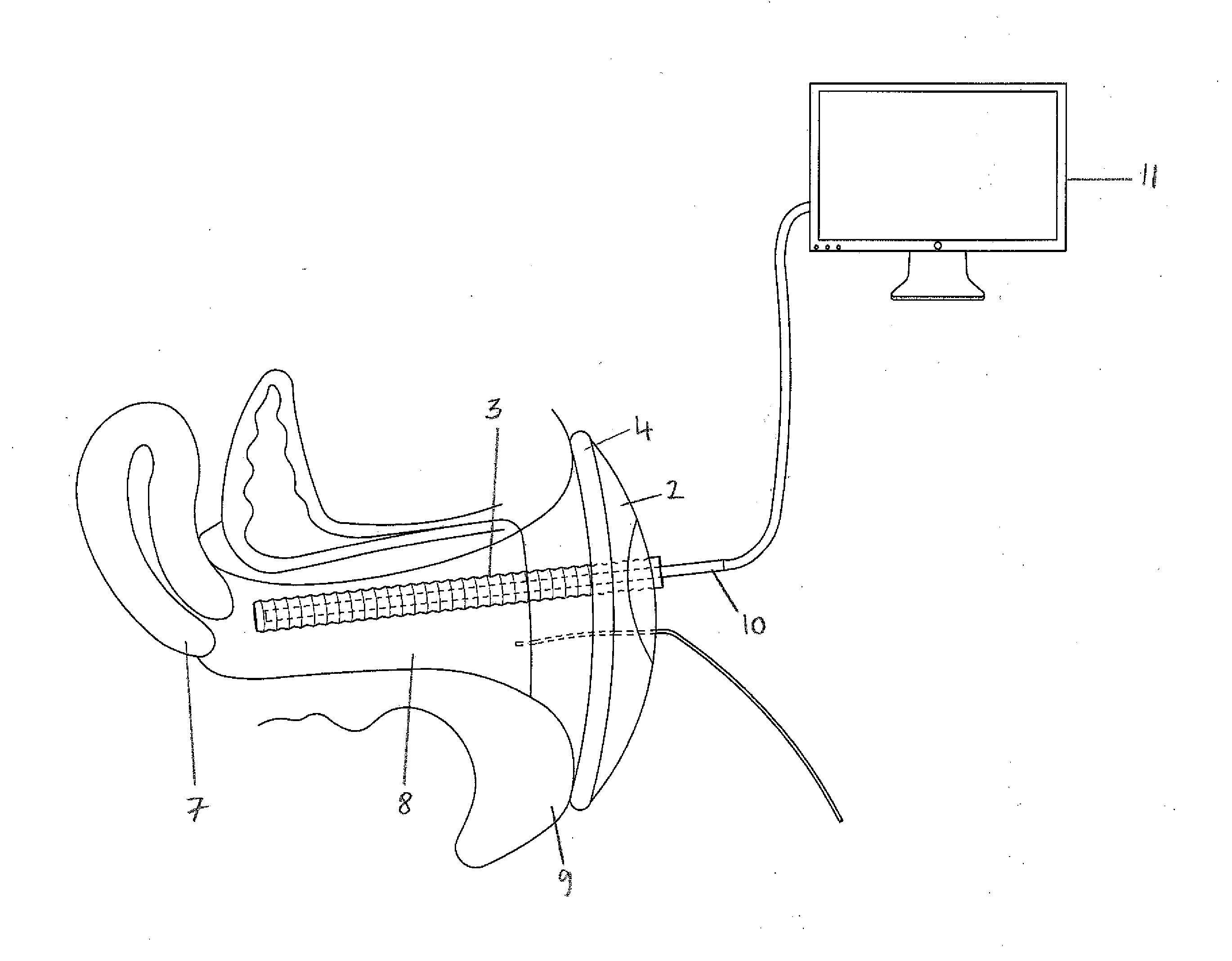 Cervical inspection device and method for cervical inspection