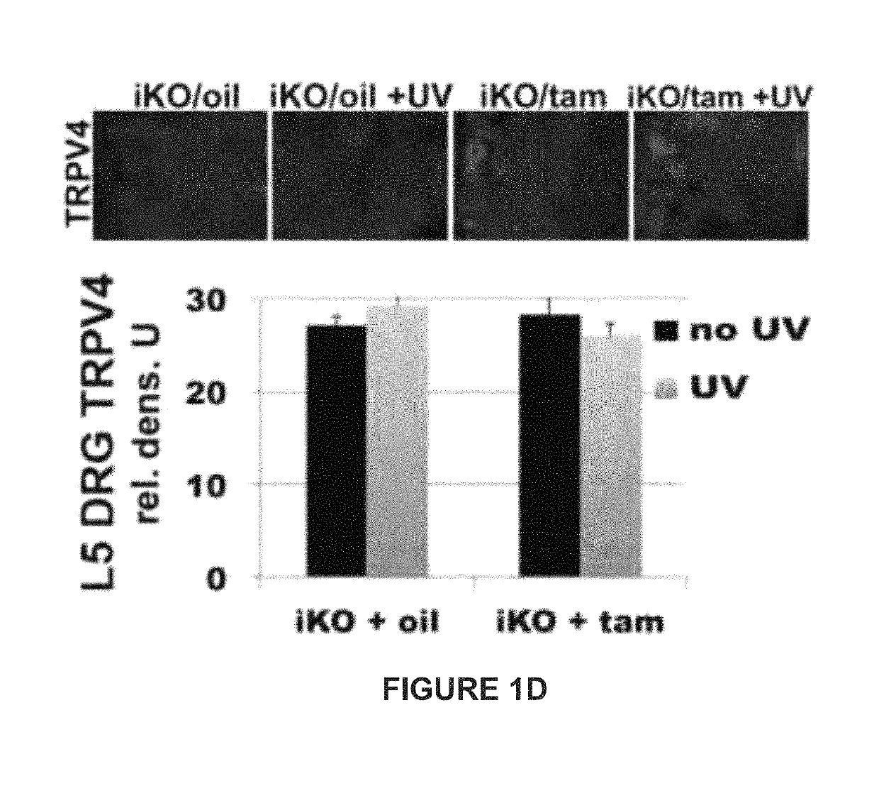 TRPA1 and TRPV4 inhibitors and methods of using the same for organ-specific inflammation and itch