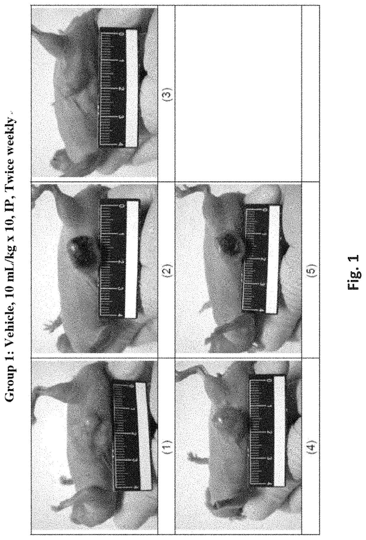 Antibodies, pharmaceutical compositions and methods