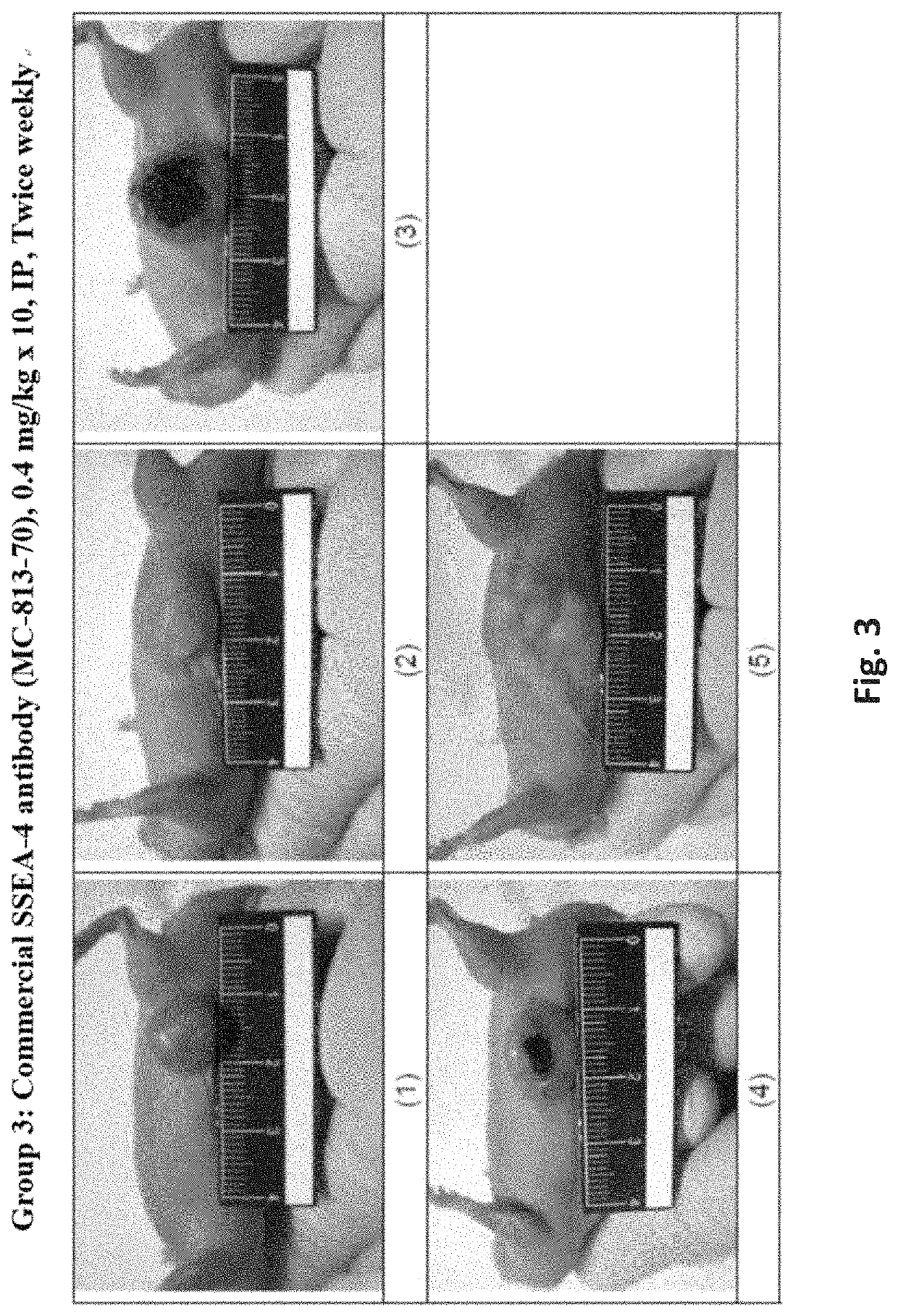 Antibodies, pharmaceutical compositions and methods