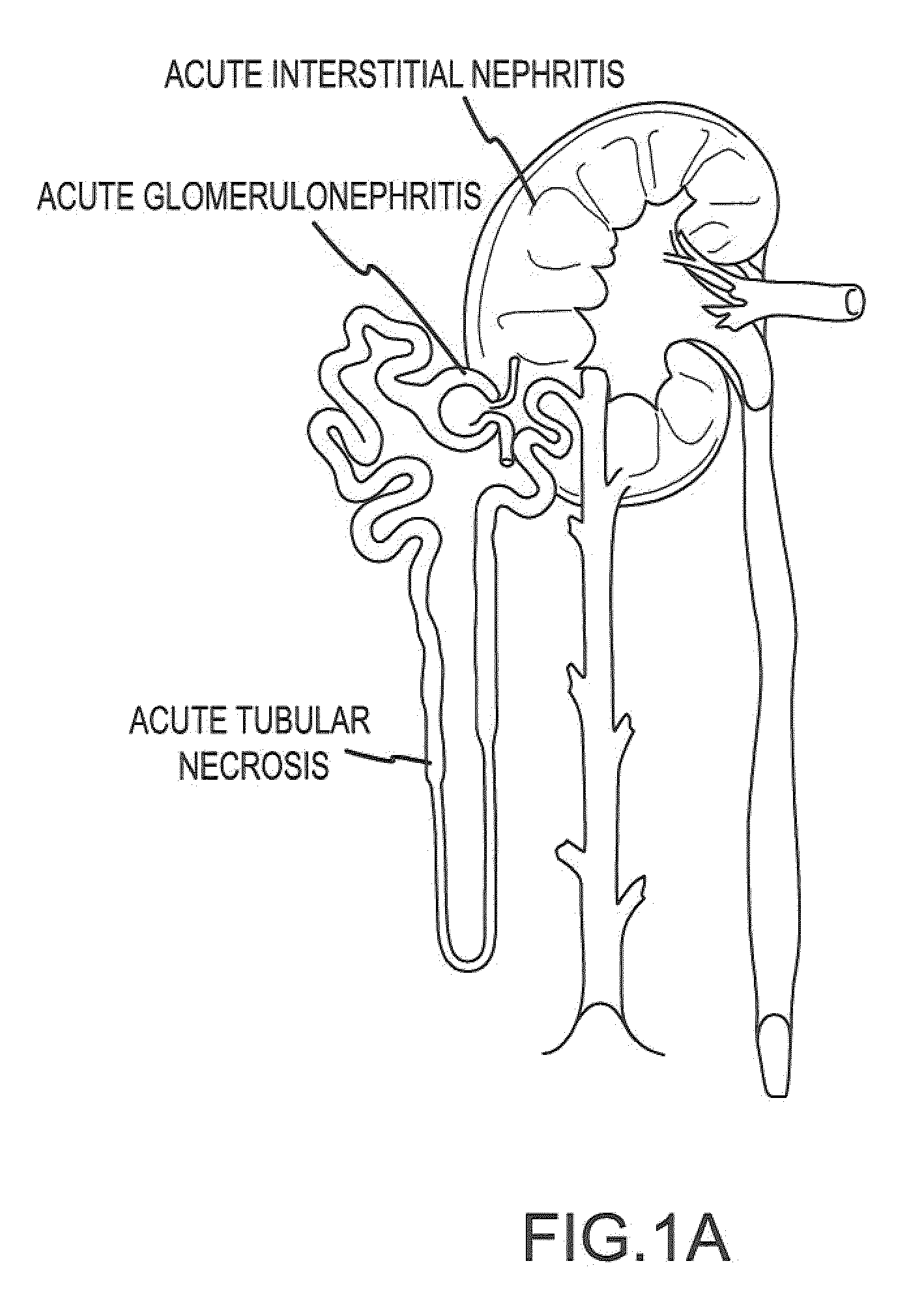 Treatment systems and methods for renal-related diseases