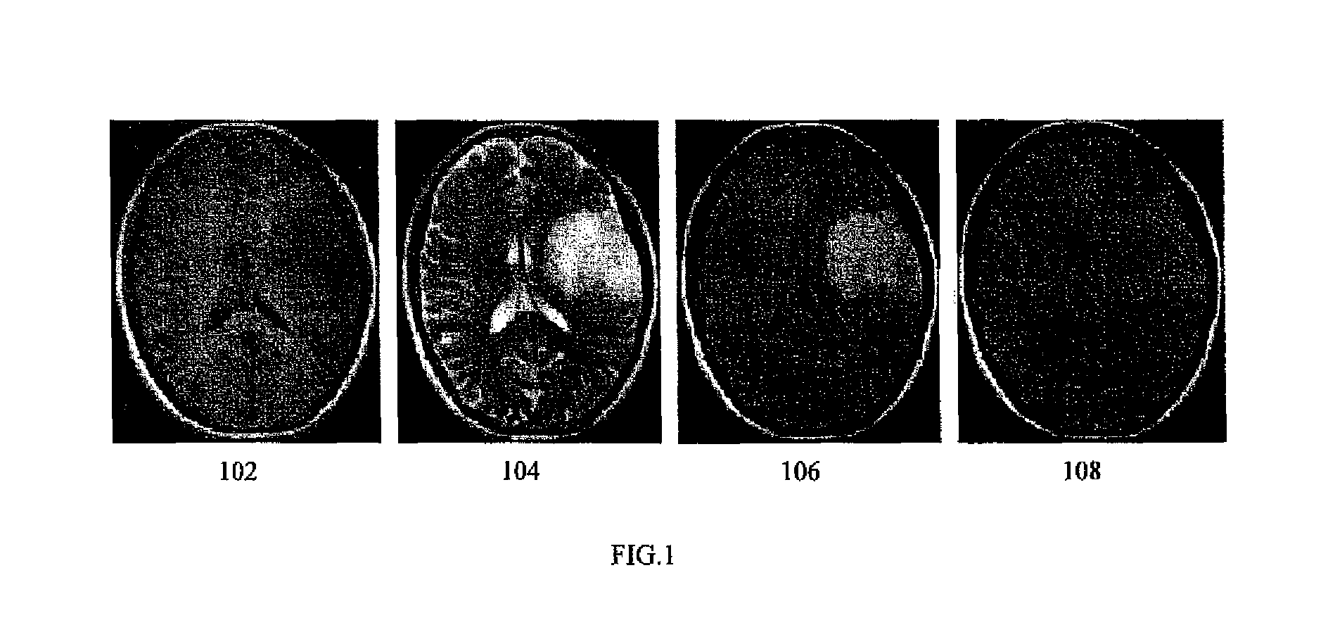 Method for brain tumor segmentation in multi-parametric image based on statistical information and multi-scale structure information