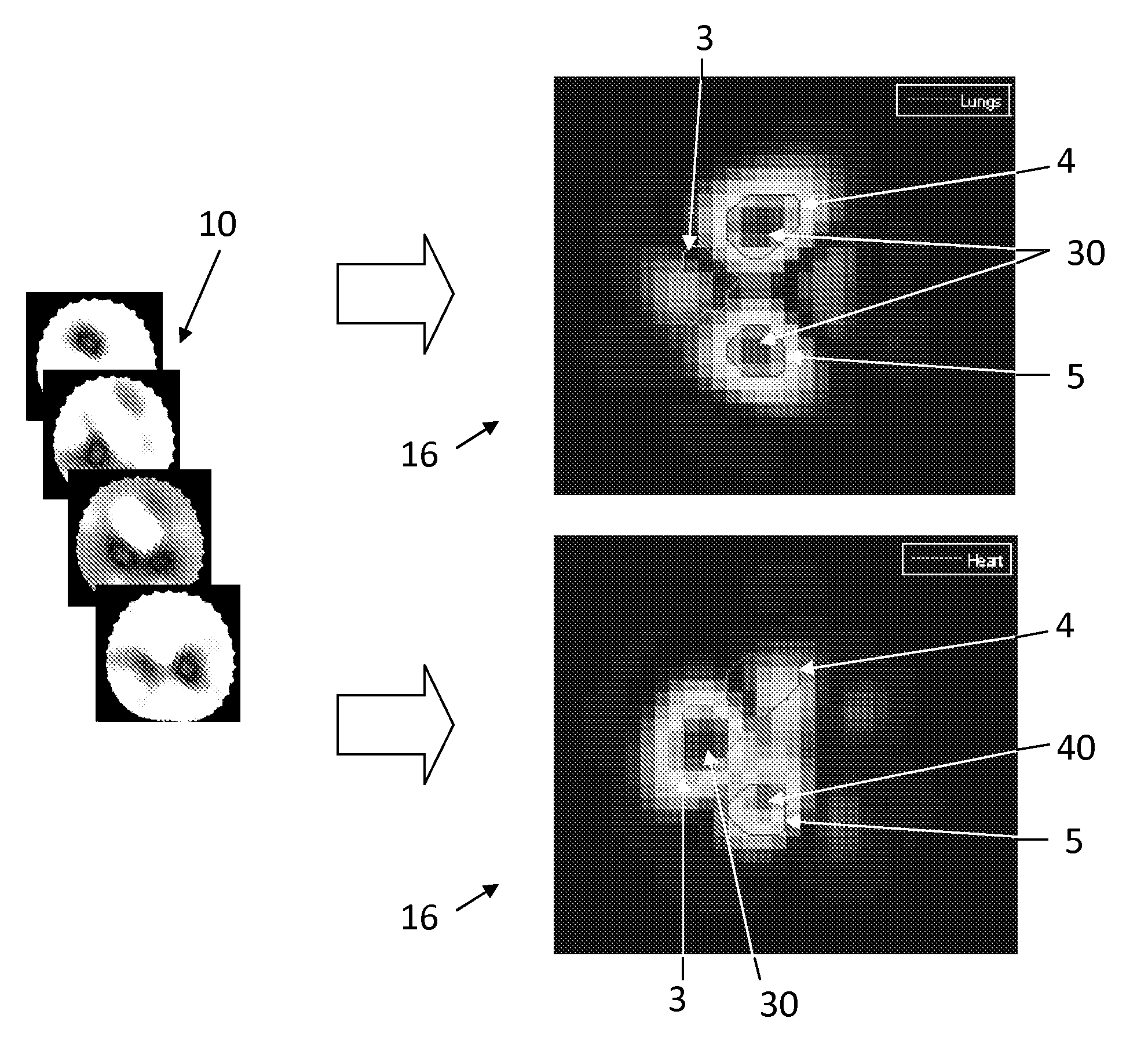 Method and Apparatus for the Non-Invasive Measurement of Pulse Transit Times (PTT)