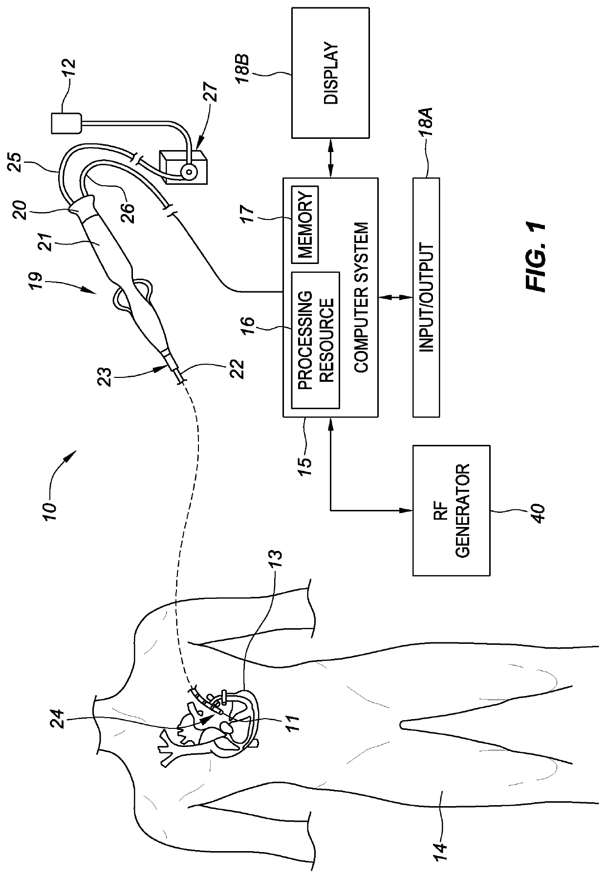 Ablation catheter tip with flexible electronic circuitry