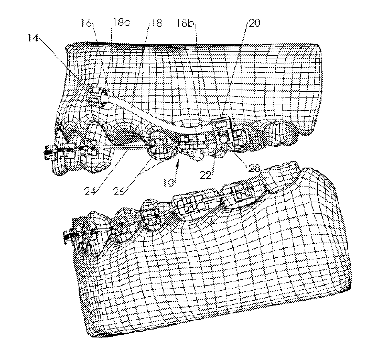 Orthodontic System Anchoring Method and Apparatus