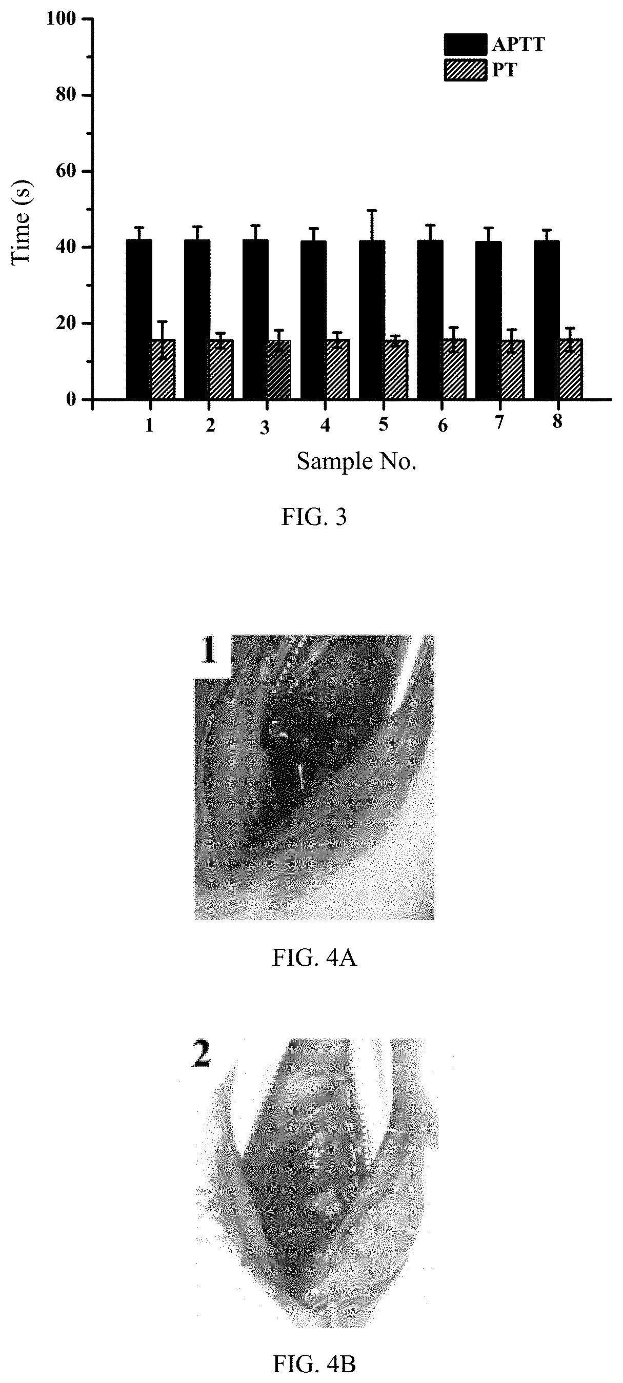 Absorbable bone wax having function of promoting bone repair and preparation method thereof