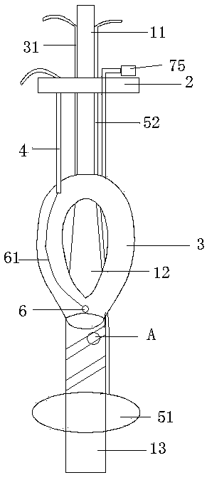 Oral cavity section fixed type tracheal catheter