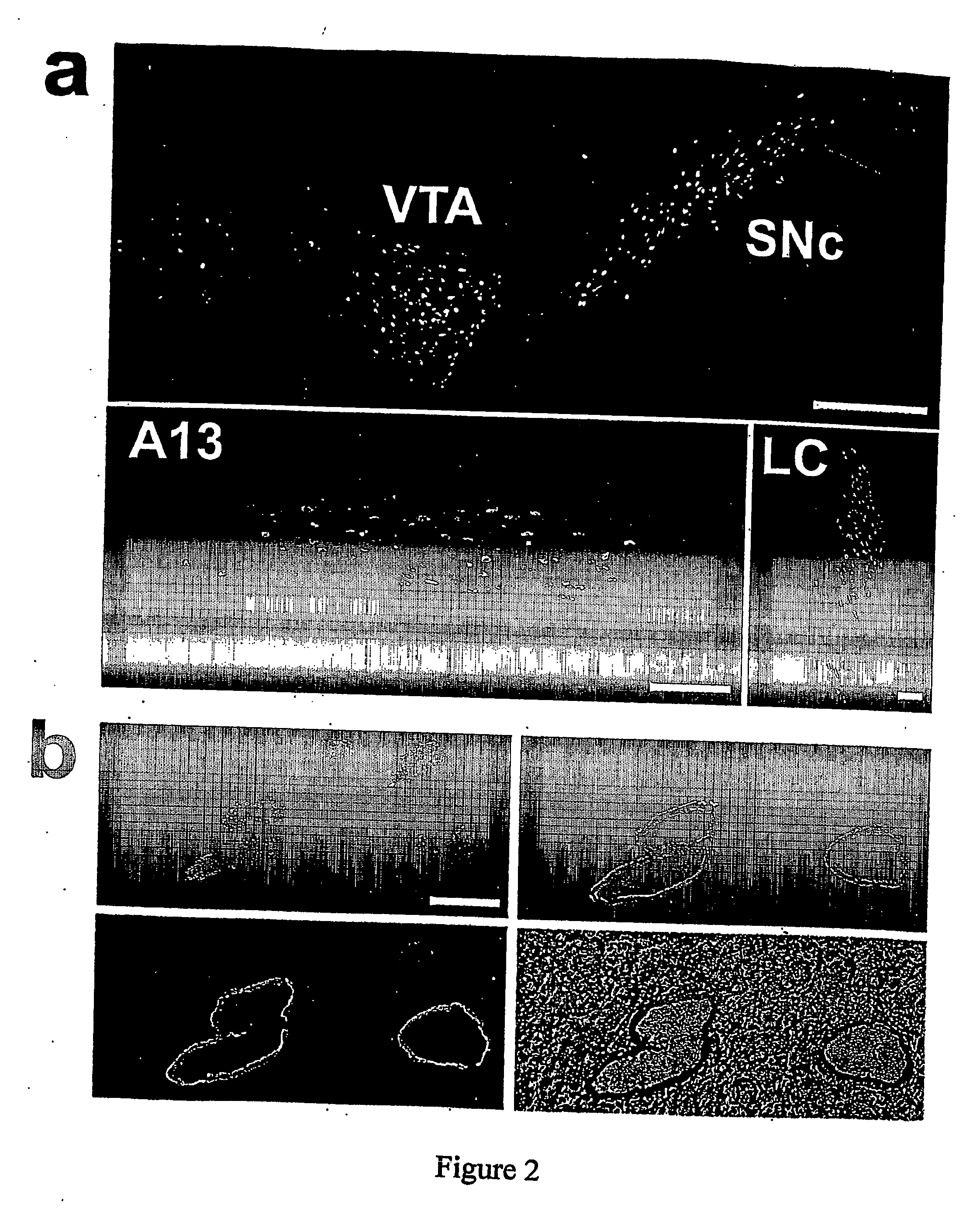 Methods For Idendifying Drug Targets And Modulators Of Neurons and Compositions Comprising The Same