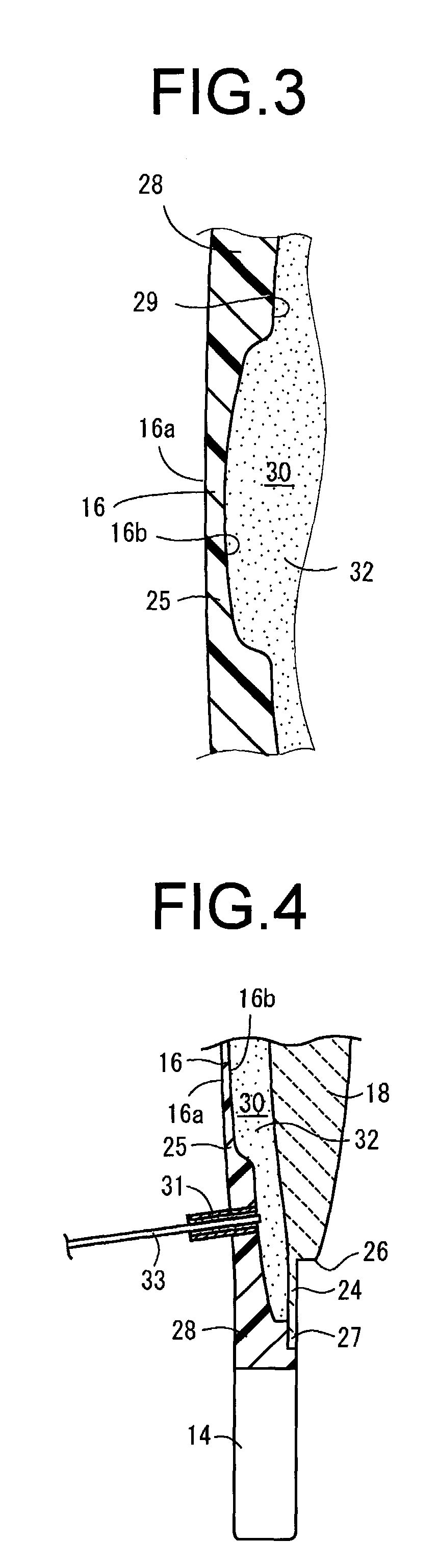 Intraocular lens