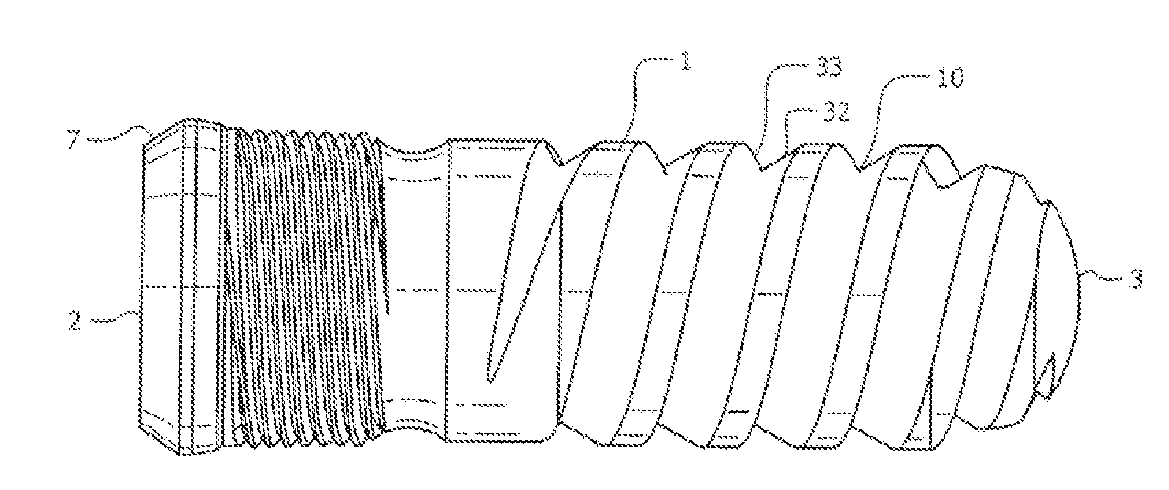 Self-Clearing Self-Cutting Implant