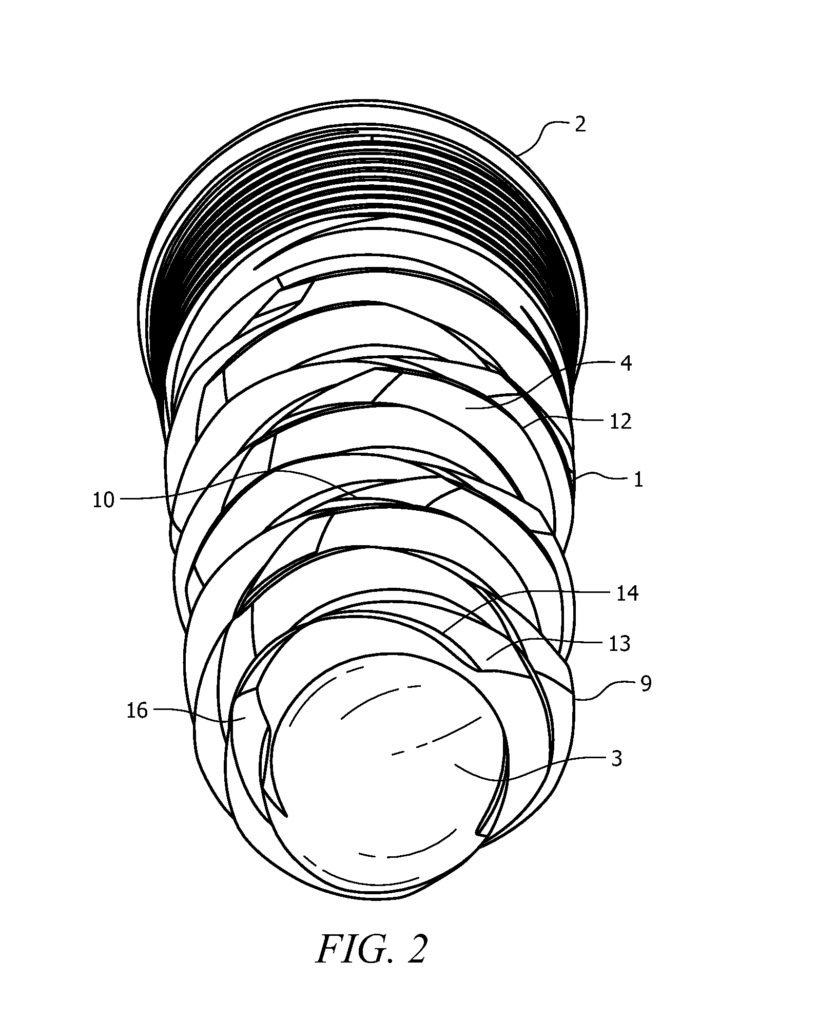 Self-Clearing Self-Cutting Implant