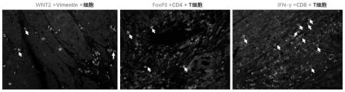 EGFP-Wnt2 fusion protein antigen, Wnt2 monoclonal antibody and application of Wnt2 monoclonal antibody