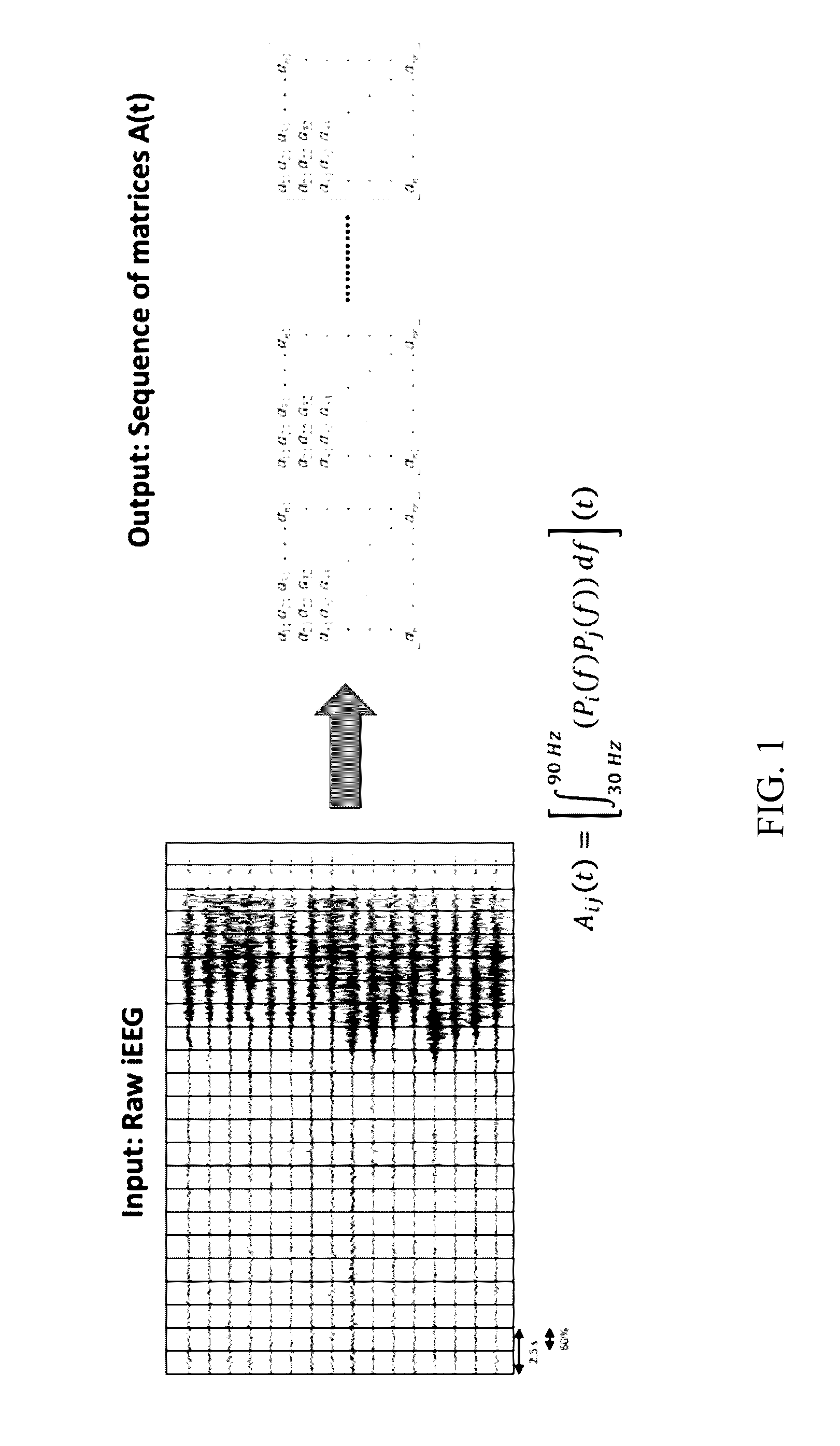 Computational tool for pre-surgical evaluation of patients with medically refractory epilepsy