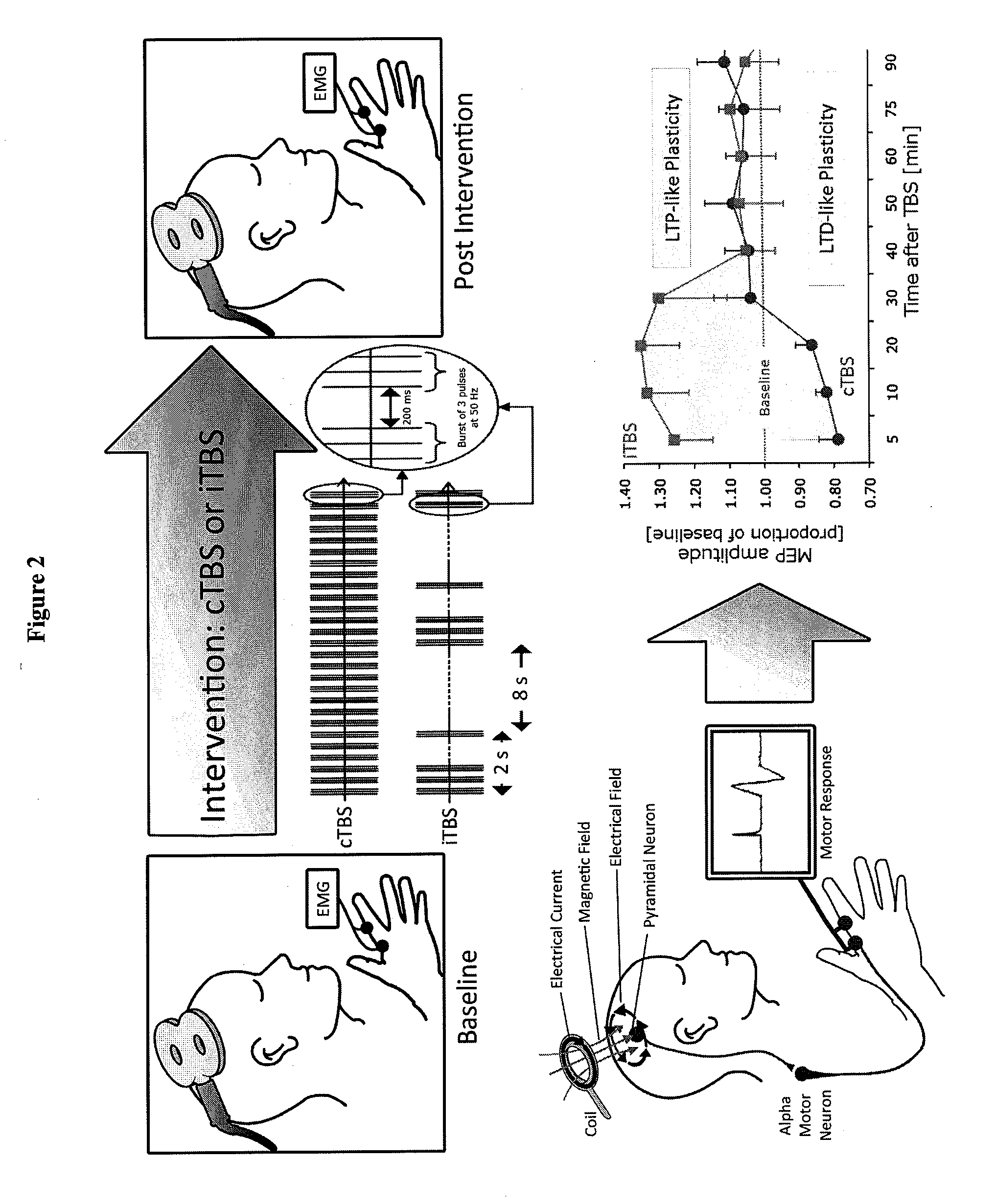 Non-invasive methods for evaluating cortical plasticity impairments