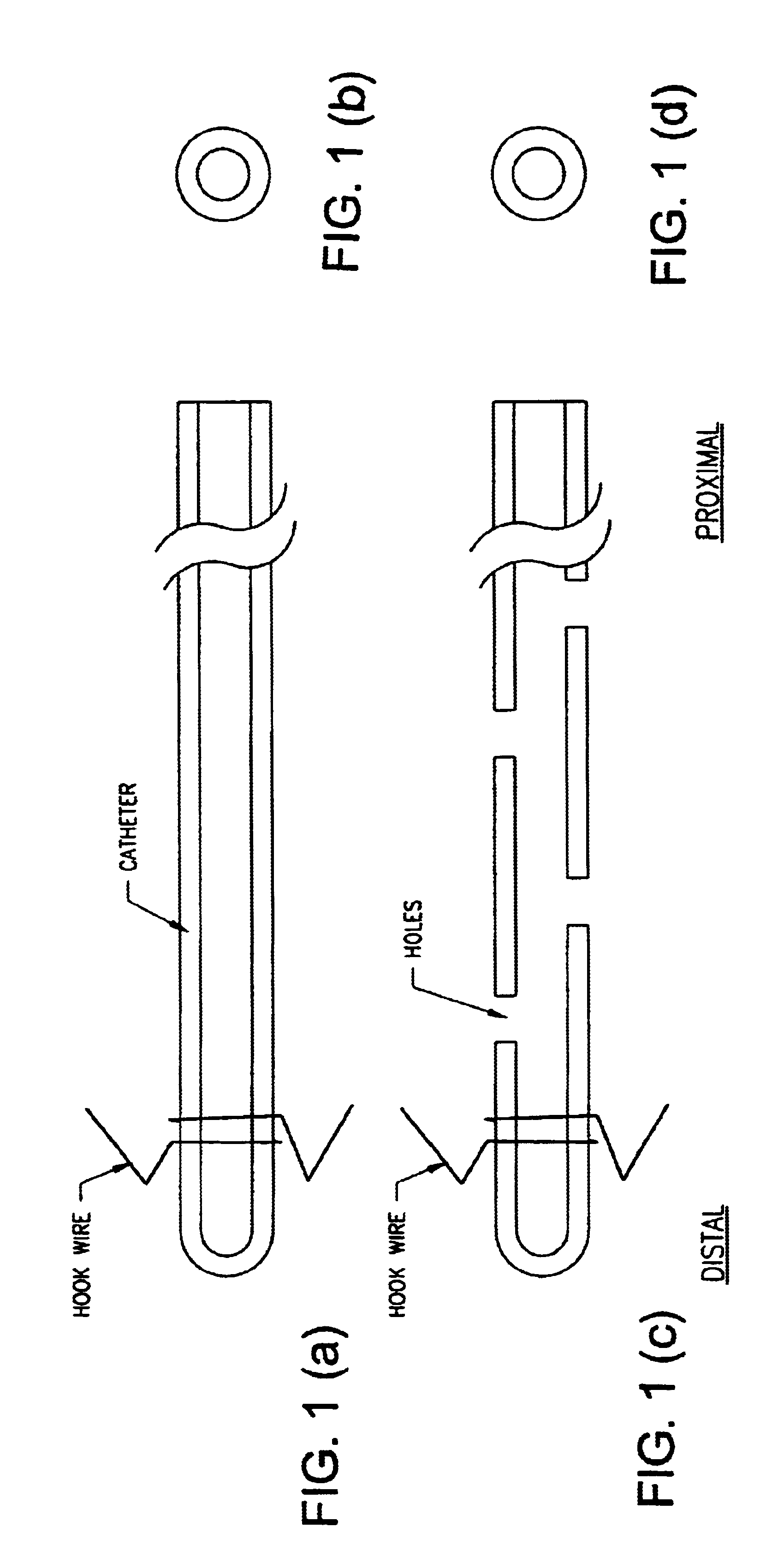 Catheters for breast surgery