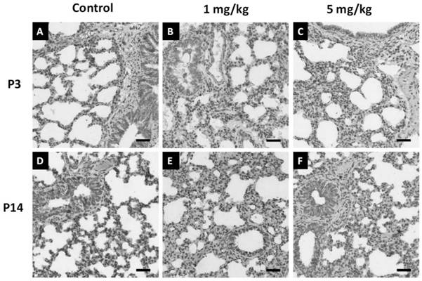 Application of perfluorooctane sulfonate in establishing bronchial pulmonary dysplasia animal model