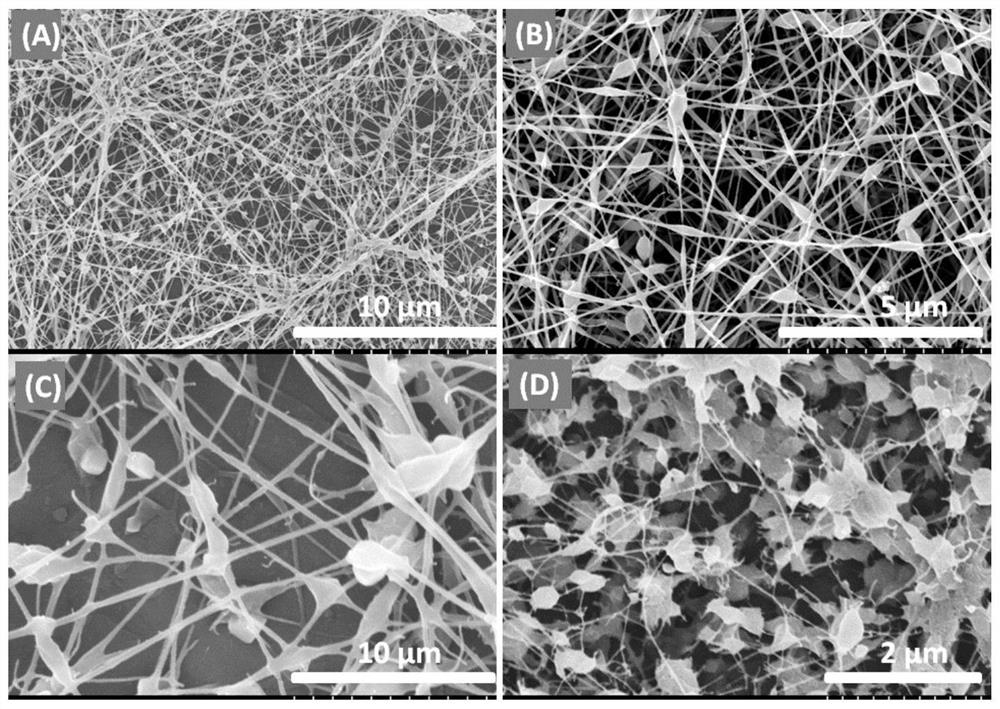 An implanted bandage for promoting the repair of bone damage and its preparation method