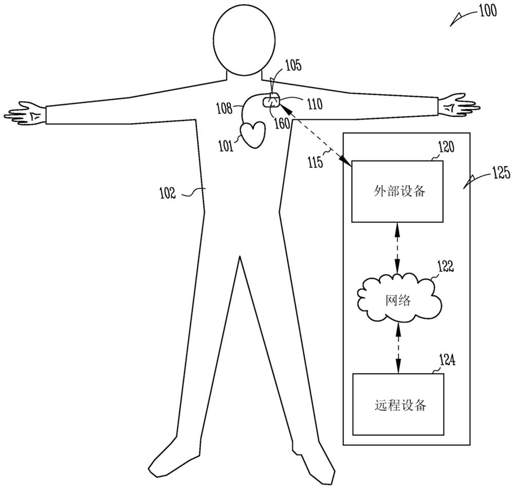 Systems and methods for reconstructing heart sounds