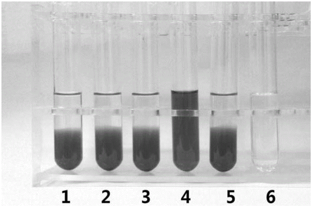 Etomidate composition for injection and preparation method thereof