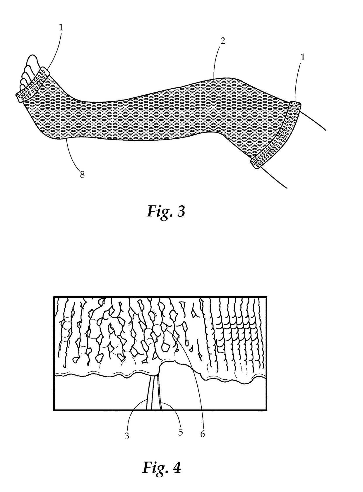 Water Activated Cast Sock