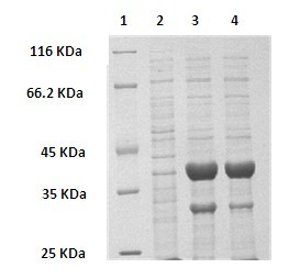 Method for preparing (R)-2-hydroxy-4-phenyl ethyl butyrate by catalyzing with recombinant carbonyl reductase