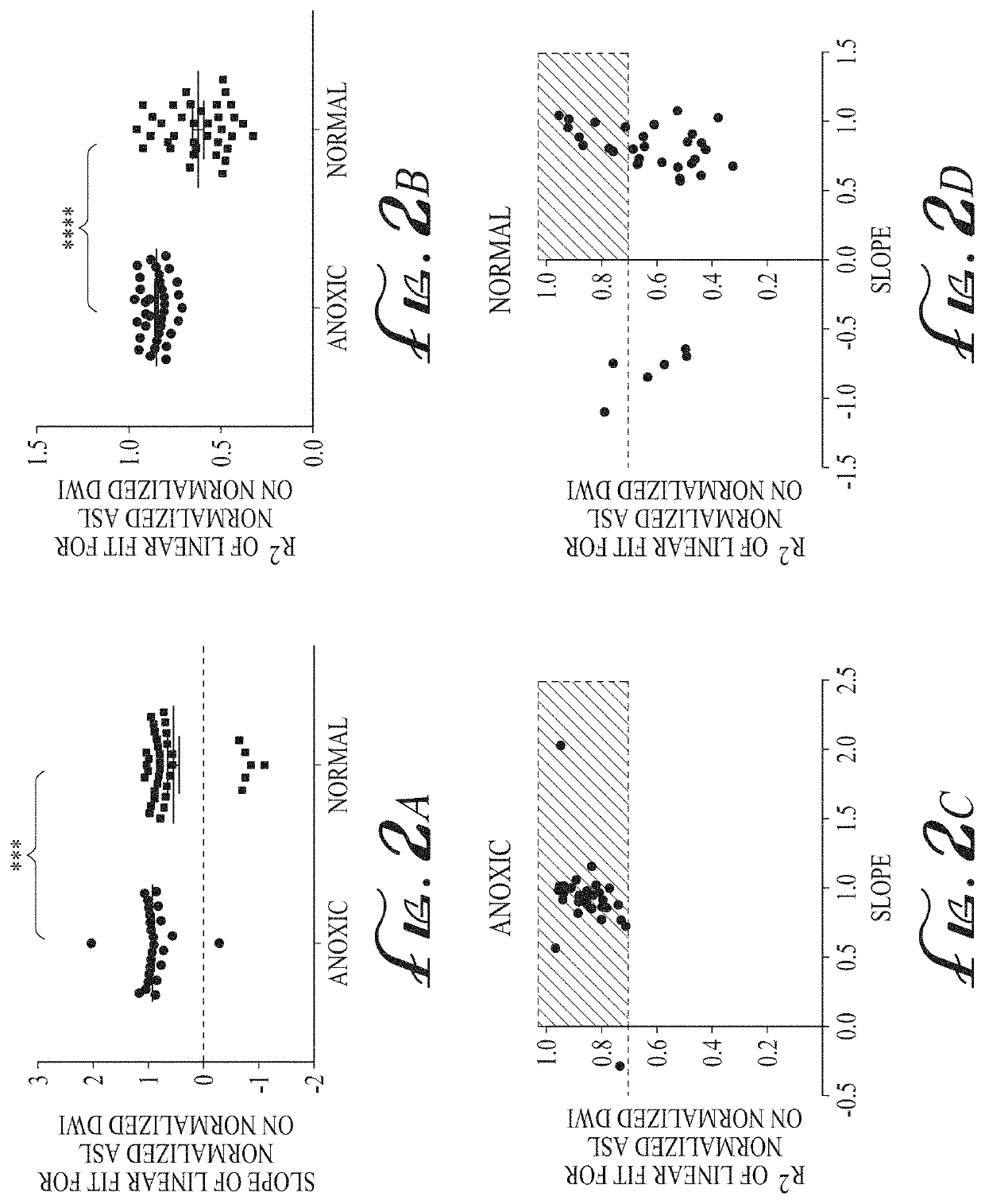 Imaging biomarkers based on ratio between diffusion and perfusion