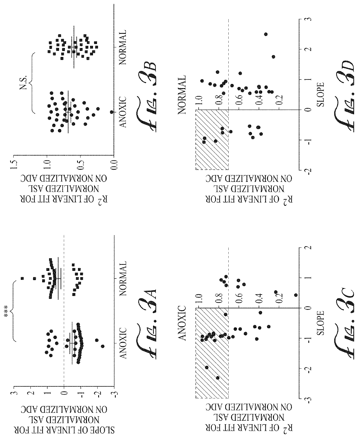 Imaging biomarkers based on ratio between diffusion and perfusion