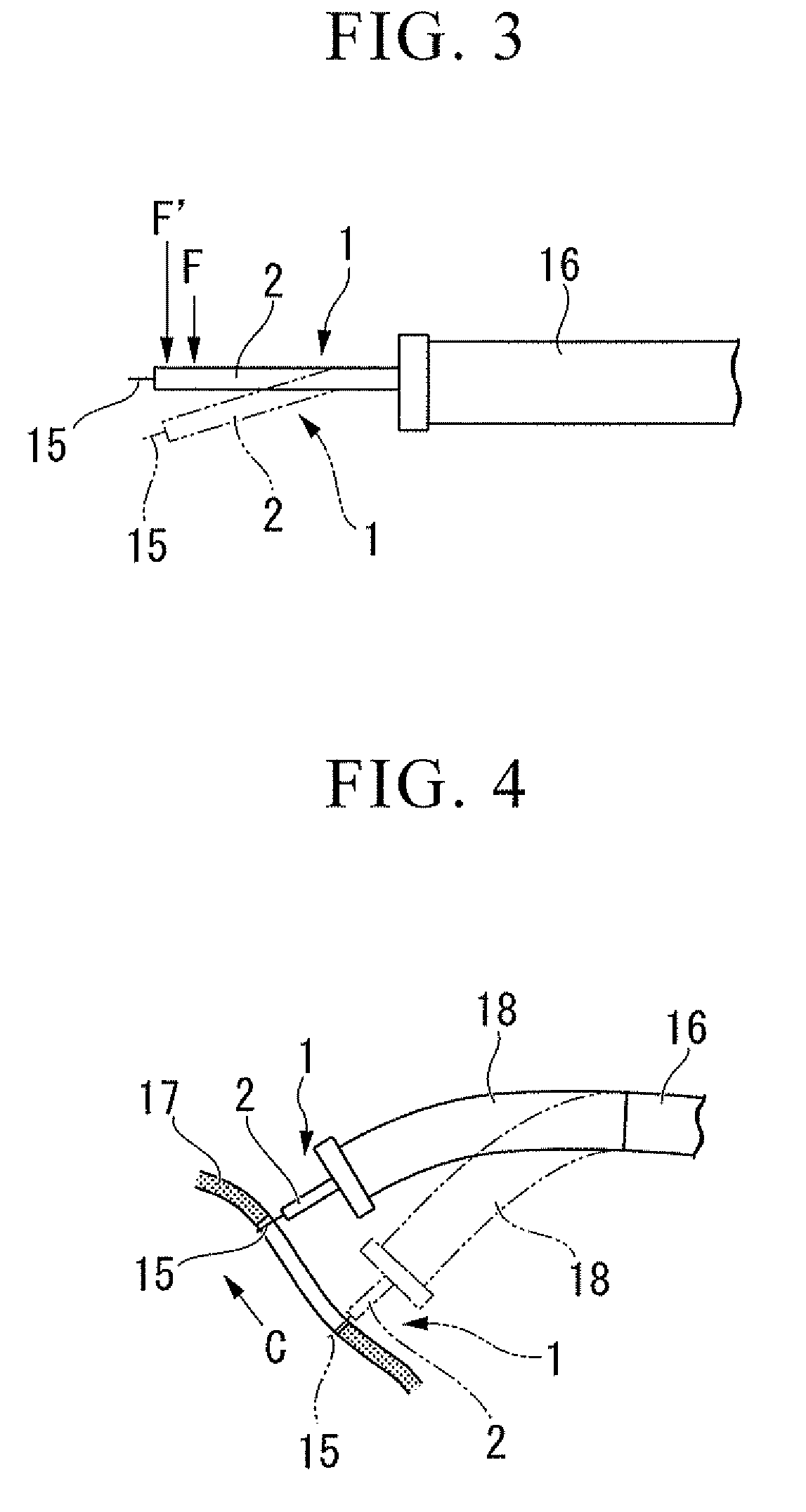 Endoscopic treatment tool