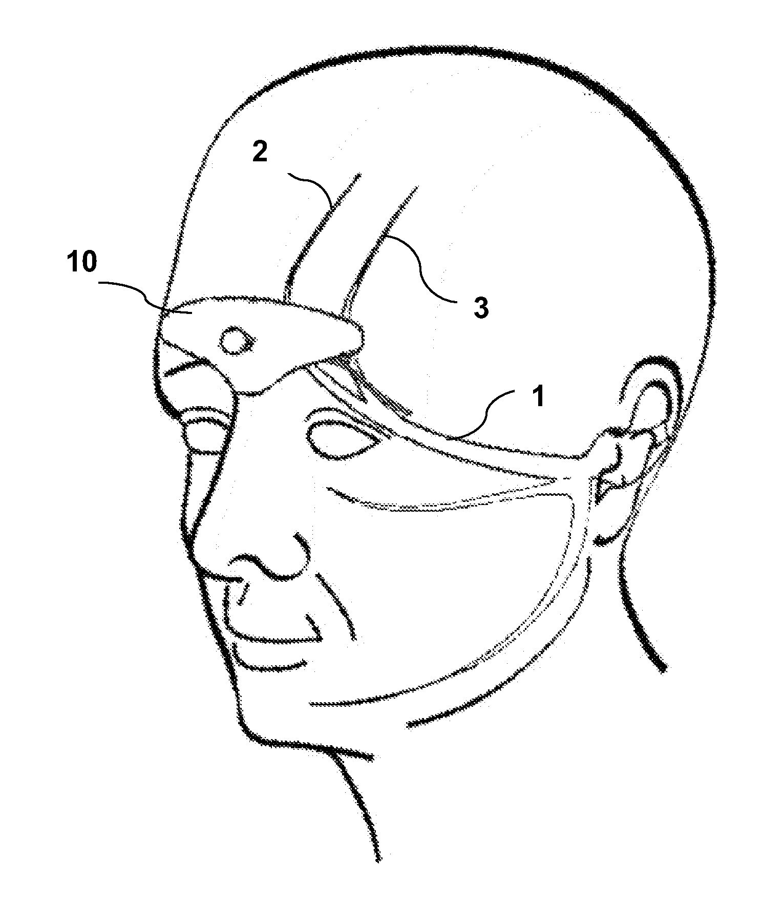 Neurostimulation Method to Induce Relaxation or Sleep