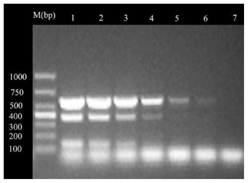 A multiple PCR detection kit for diagnosing poultry tuberculosis and its detection method