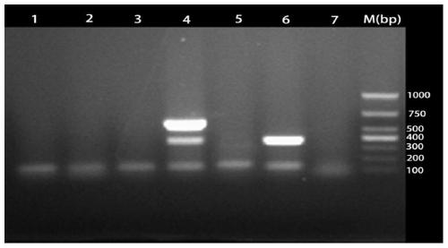 A multiple PCR detection kit for diagnosing poultry tuberculosis and its detection method