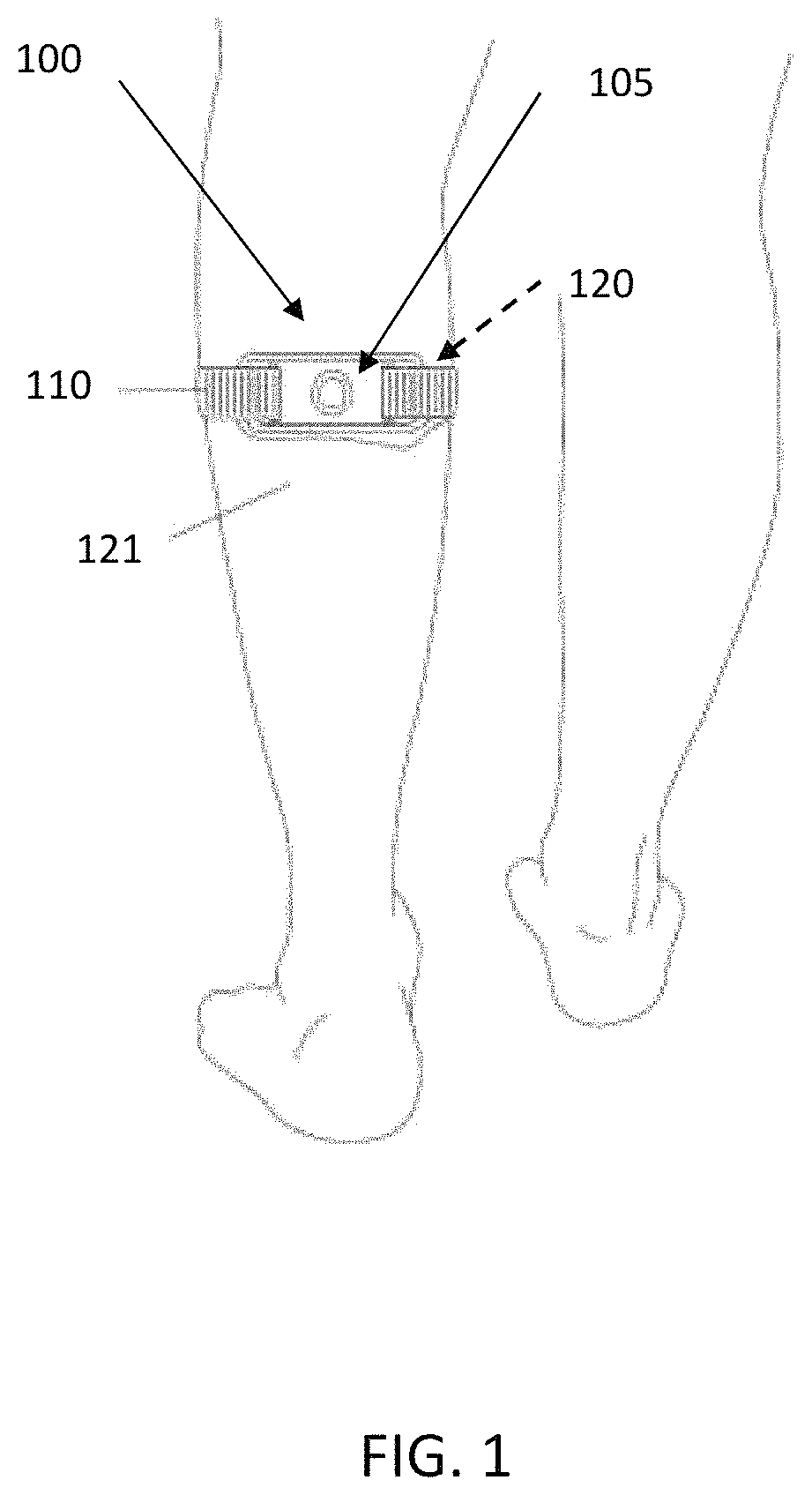 “Smart” electrode assembly for transcutaneous electrical nerve stimulation (TENS)