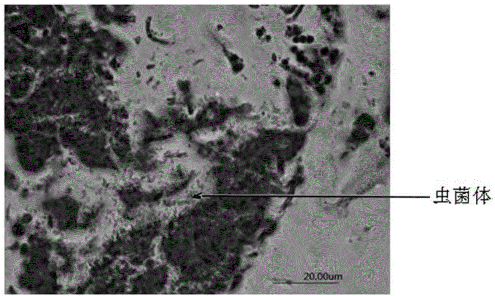 Improved Grocott silver hexosamine staining method and applications thereof