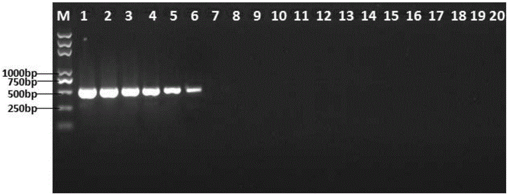 Multiple PCR detection primers of escherichia coli, pseudomonas aeruginosa and staphylococcus aureus, kit and detection method