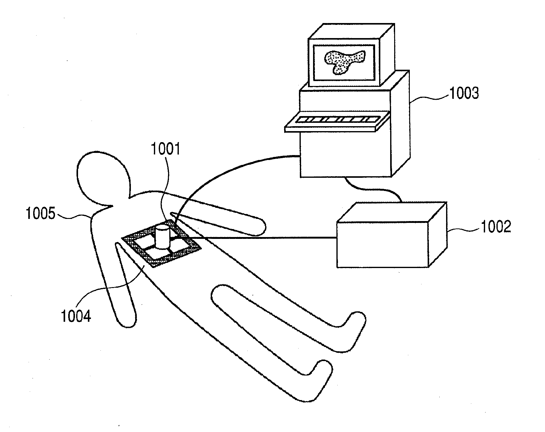 Ultrasonic diagnostic imaging system and control method thereof