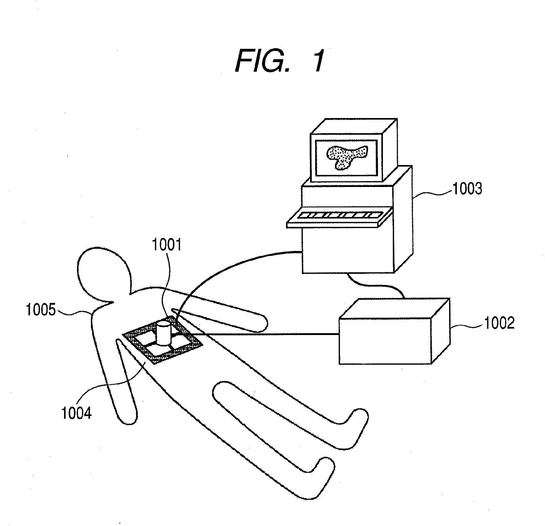 Ultrasonic diagnostic imaging system and control method thereof